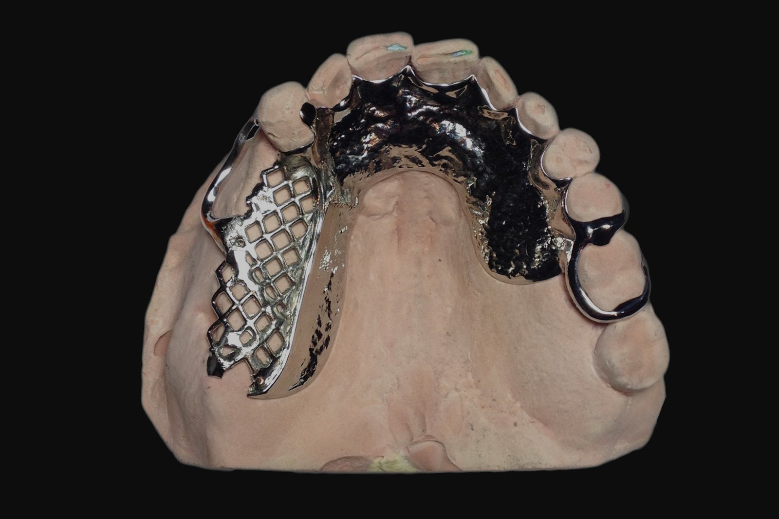 Chrome Cobalt Dentures